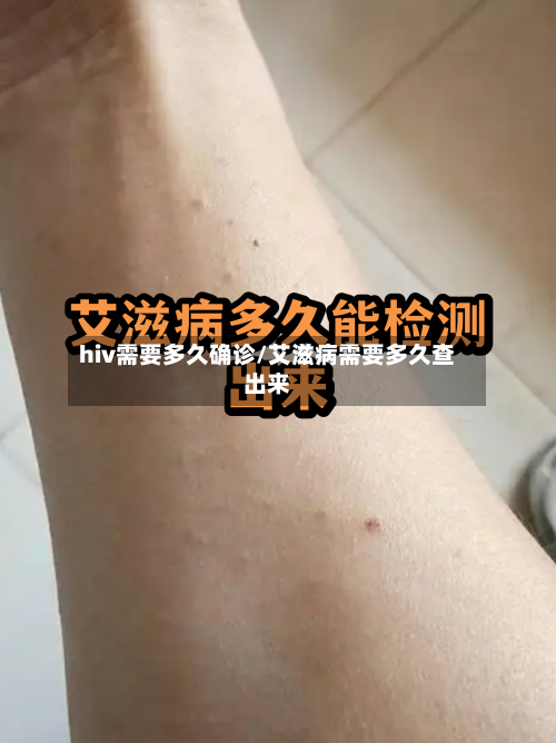 hiv需要多久确诊/艾滋病需要多久查出来