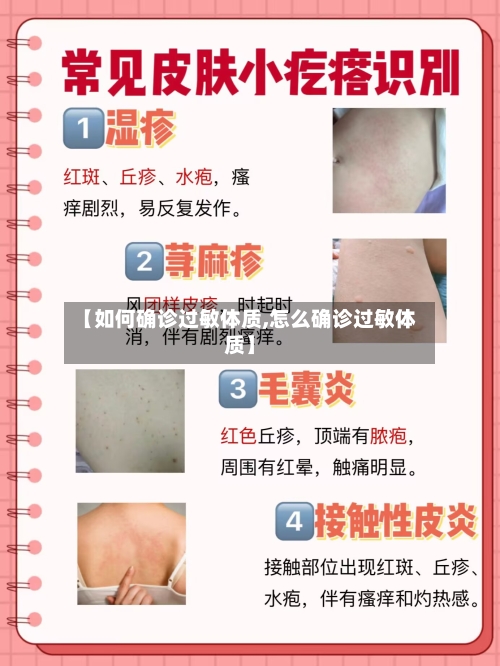 【如何确诊过敏体质,怎么确诊过敏体质】-第2张图片
