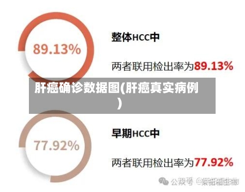 肝癌确诊数据图(肝癌真实病例)-第2张图片