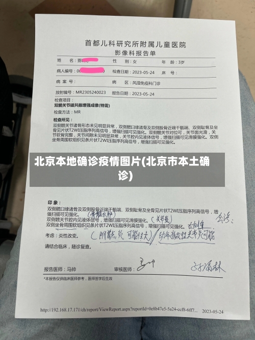 北京本地确诊疫情图片(北京市本土确诊)-第3张图片