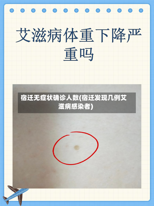 宿迁无症状确诊人数(宿迁发现几例艾滋病感染者)-第2张图片