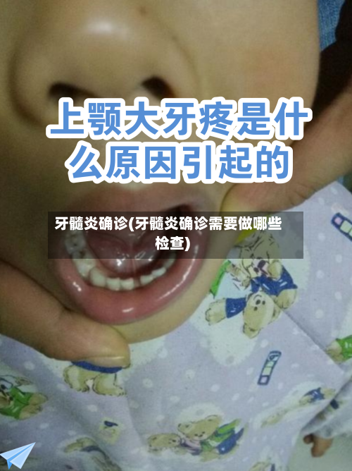 牙髓炎确诊(牙髓炎确诊需要做哪些检查)-第3张图片