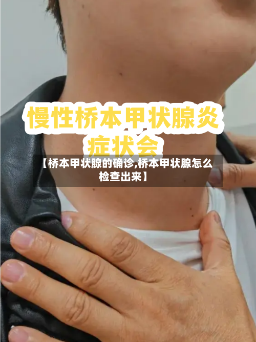 【桥本甲状腺的确诊,桥本甲状腺怎么检查出来】