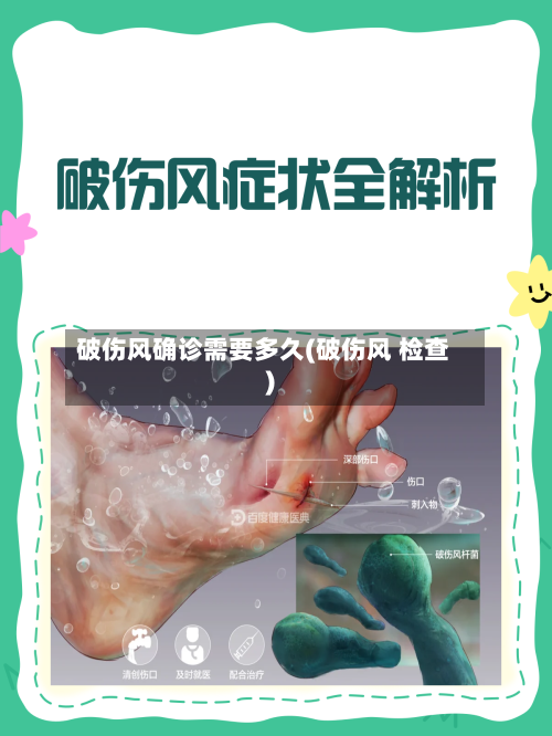 破伤风确诊需要多久(破伤风 检查)