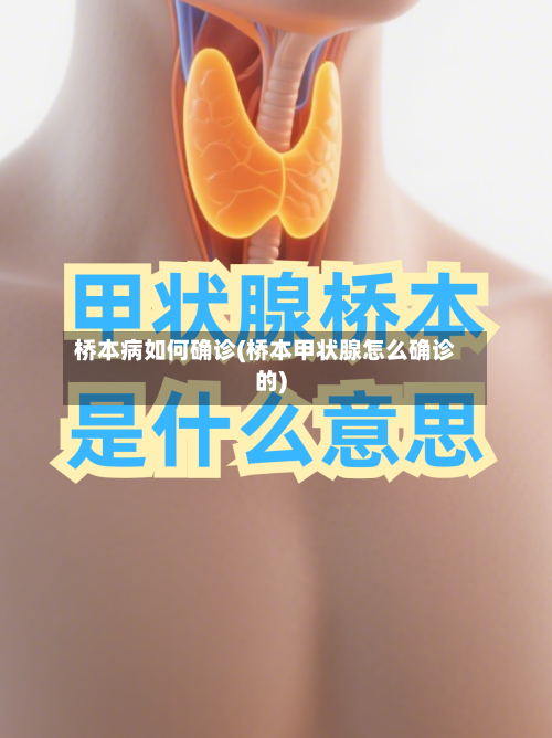 桥本病如何确诊(桥本甲状腺怎么确诊的)-第2张图片