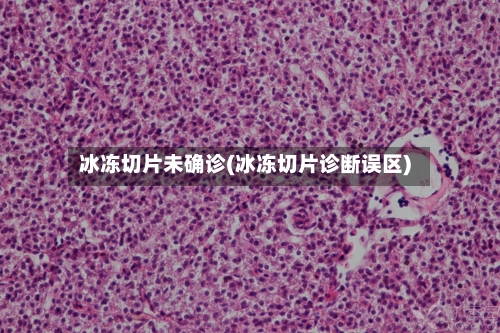 冰冻切片未确诊(冰冻切片诊断误区)-第2张图片