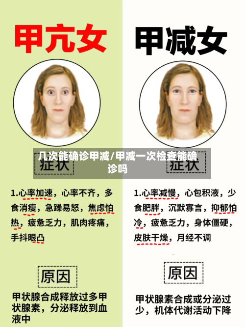 几次能确诊甲减/甲减一次检查能确诊吗-第2张图片