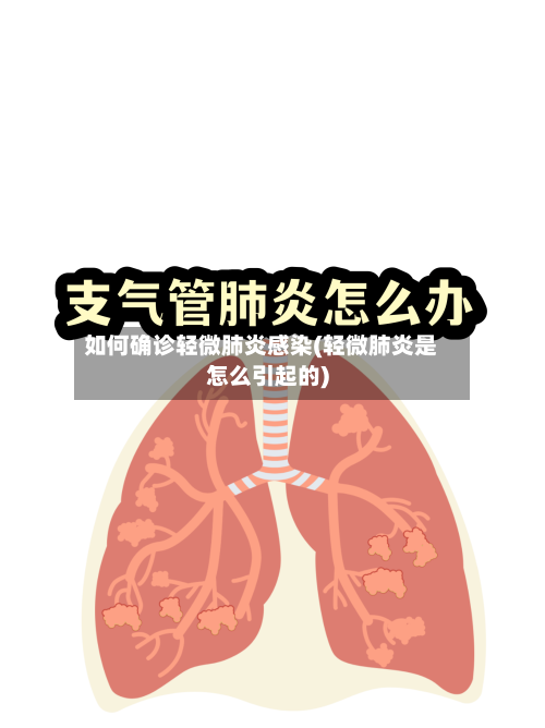 如何确诊轻微肺炎感染(轻微肺炎是怎么引起的)-第2张图片
