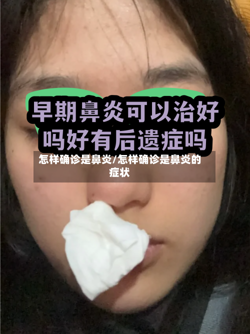 怎样确诊是鼻炎/怎样确诊是鼻炎的症状-第2张图片