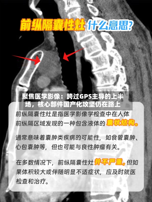 聚焦医学影像：跨过GPS主导的上半场	，核心部件国产化攻坚仍在路上-第2张图片