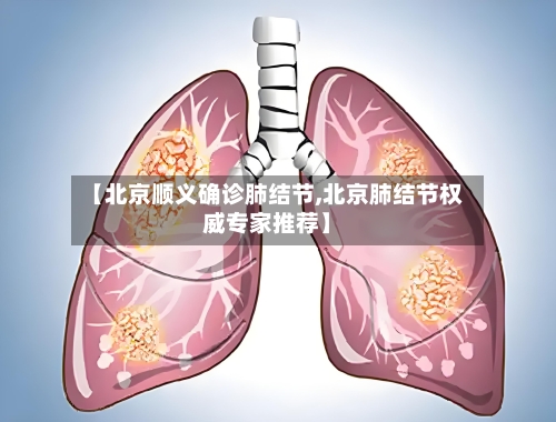 【北京顺义确诊肺结节,北京肺结节权威专家推荐】