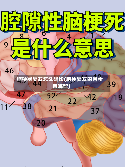 脑梗塞复发怎么确诊(脑梗复发的因素有哪些)-第2张图片