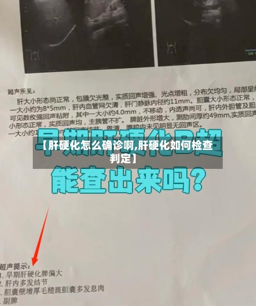 【肝硬化怎么确诊啊,肝硬化如何检查判定】-第3张图片