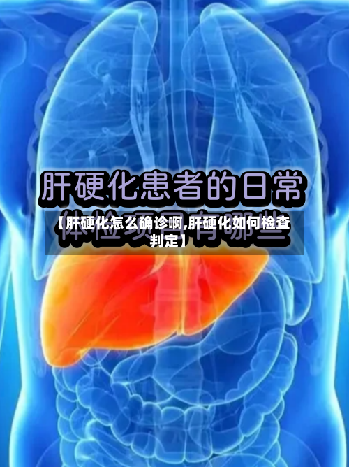 【肝硬化怎么确诊啊,肝硬化如何检查判定】