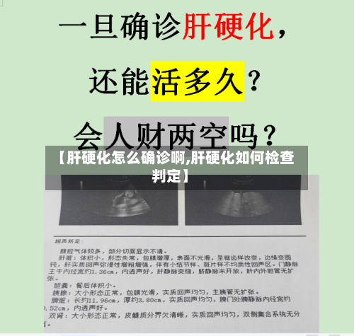 【肝硬化怎么确诊啊,肝硬化如何检查判定】-第2张图片