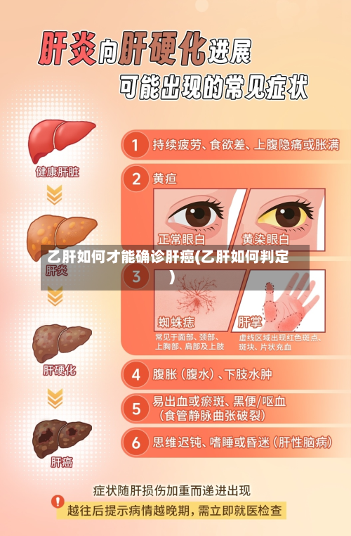 乙肝如何才能确诊肝癌(乙肝如何判定)-第2张图片
