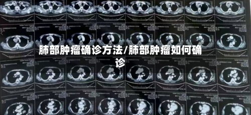 肺部肿瘤确诊方法/肺部肿瘤如何确诊-第2张图片