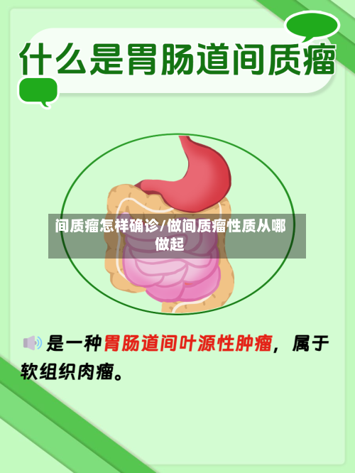 间质瘤怎样确诊/做间质瘤性质从哪做起