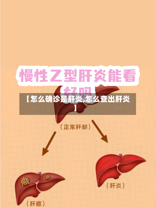 【怎么确诊是肝炎,怎么查出肝炎】-第2张图片