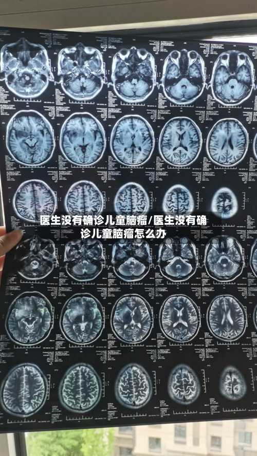 医生没有确诊儿童脑瘤/医生没有确诊儿童脑瘤怎么办-第2张图片