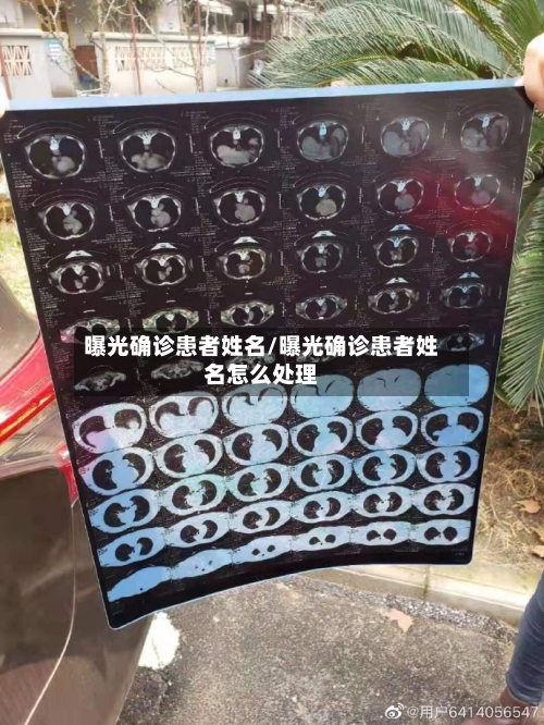 曝光确诊患者姓名/曝光确诊患者姓名怎么处理-第2张图片